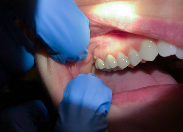  Cleveland, NC Emergency Dentist Pros