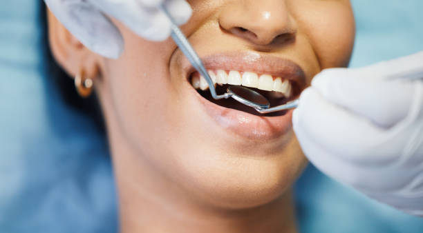 Best Emergency Tooth Extraction in Cleveland, NC