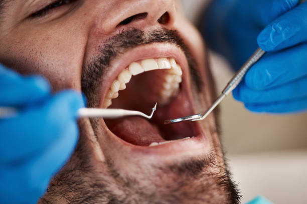 Best Same-Day Emergency Dental Services in Cleveland, NC