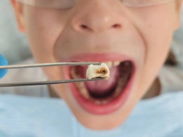 Best Emergency Denture Repair in Cleveland, NC